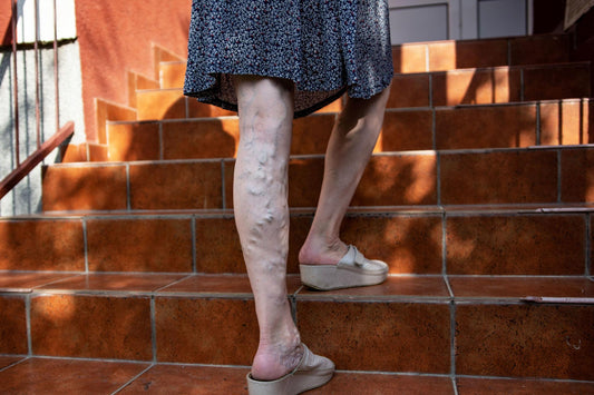 Natural Care for Healthy & Comfortable Legs